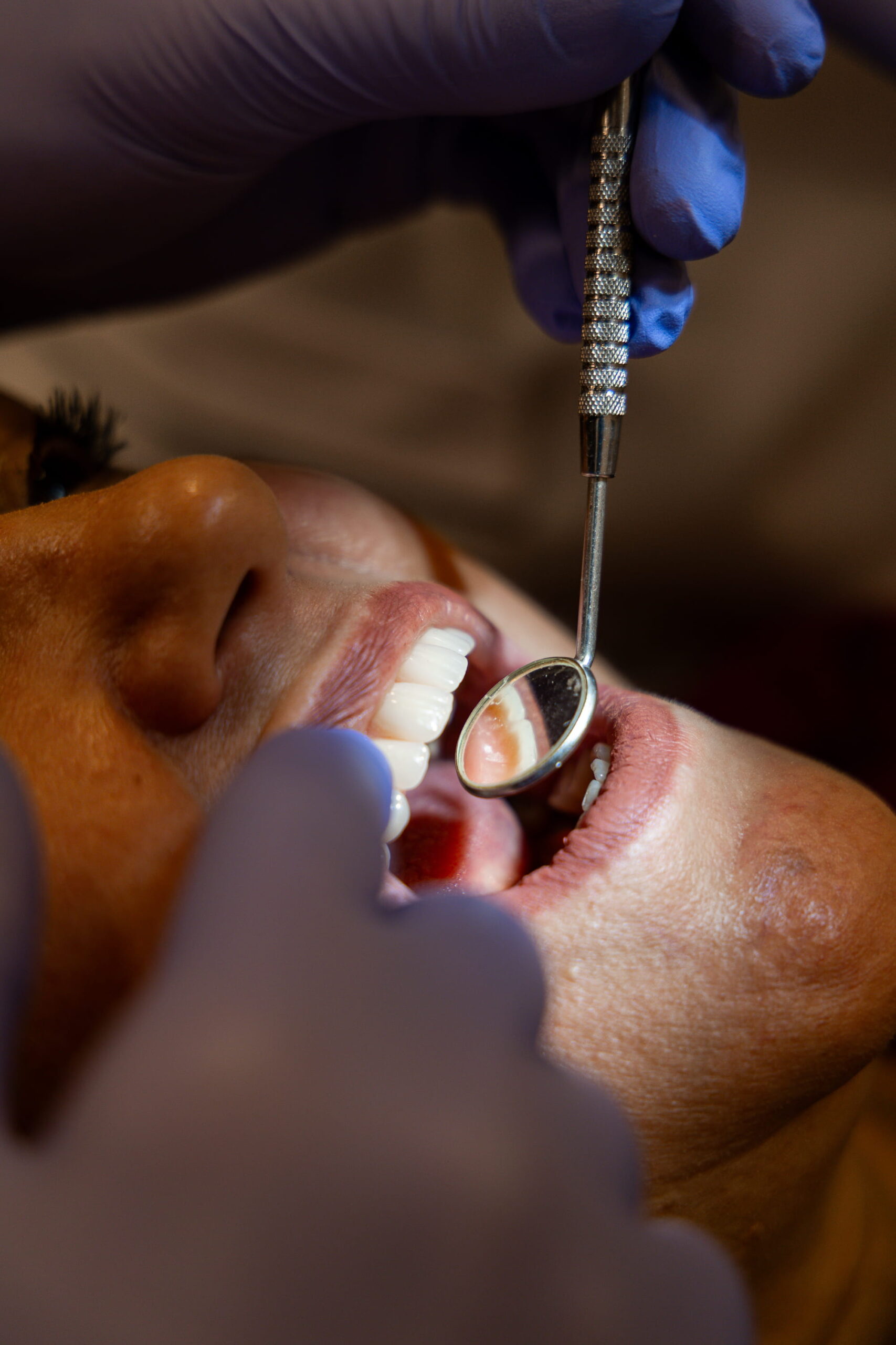 Especialidade Medicina Dentária | Higiene Oral