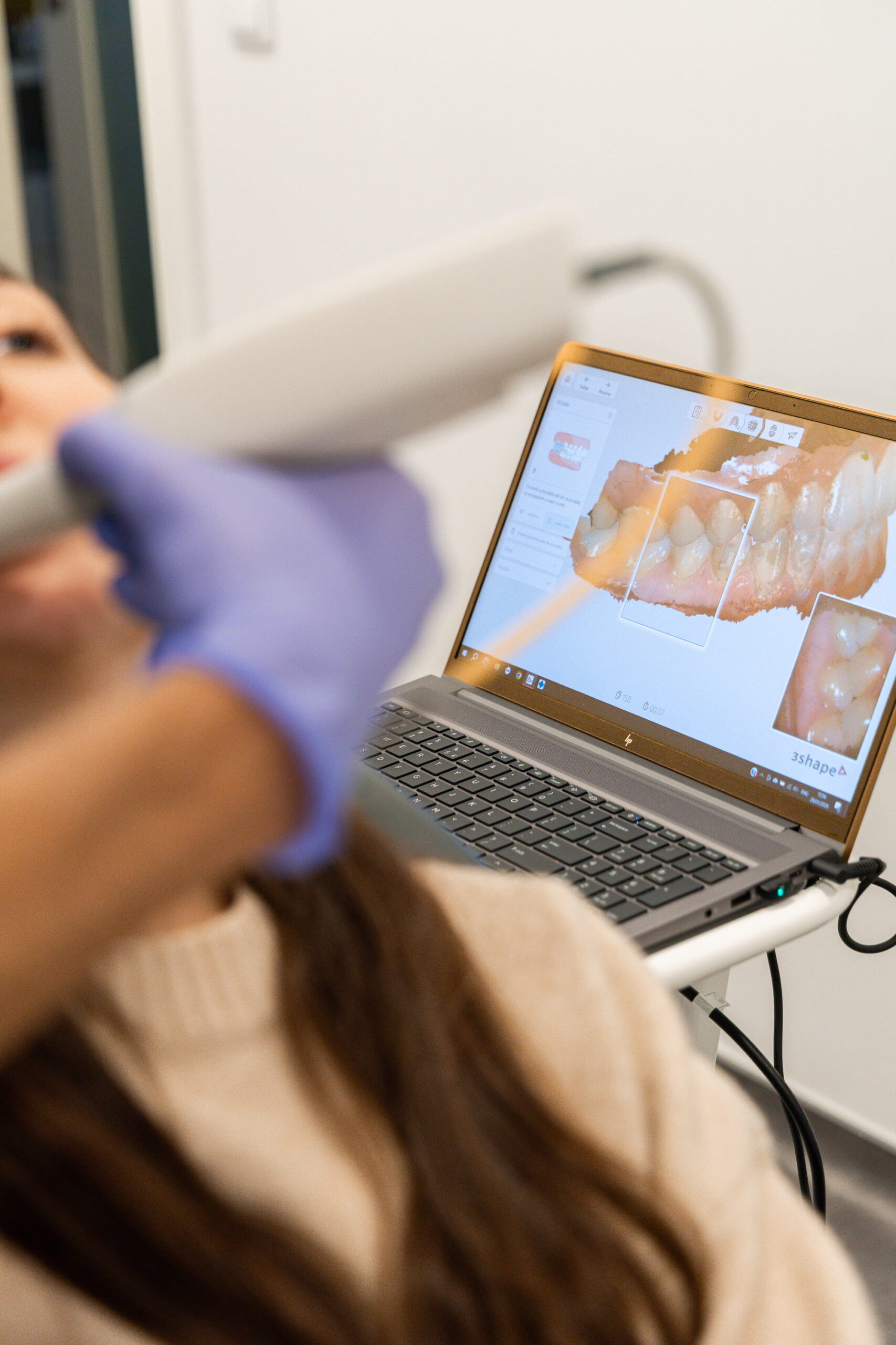 Especialidade Medicina Dentária | Reabilitação Oral